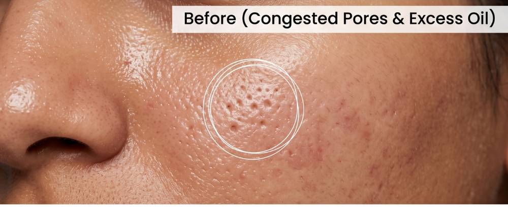 Before Treatment