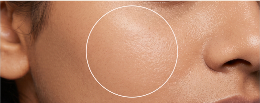 After Treatment