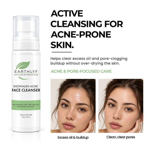 Snowmush Acne Face Cleanser