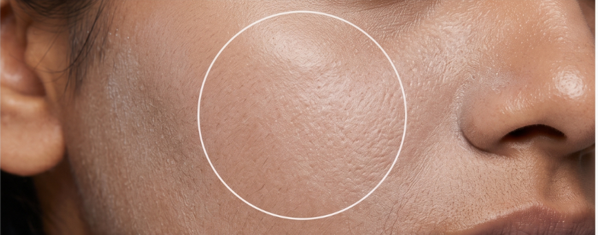 Before Treatment